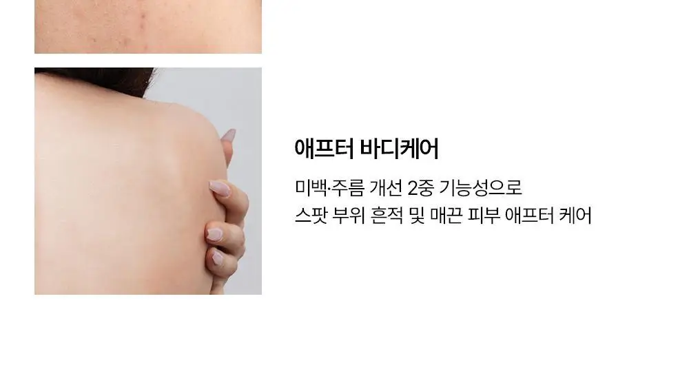[등드름/가드름] 낫포유 클리어 SOS 바디패드 10매입 상세페이지 24